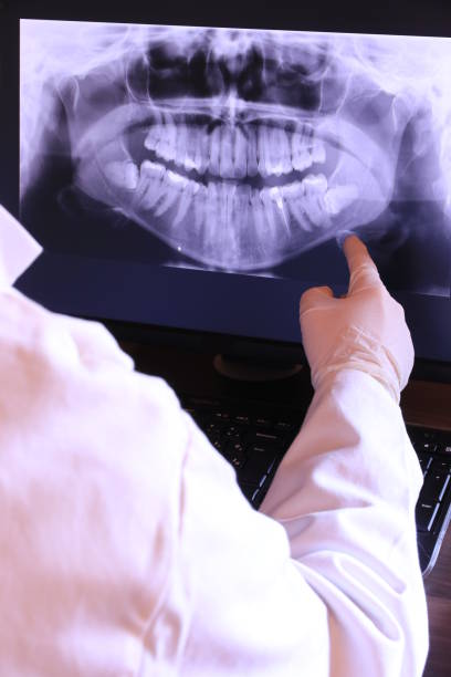 Best Emergency Root Canal Treatment in Windsor, NC